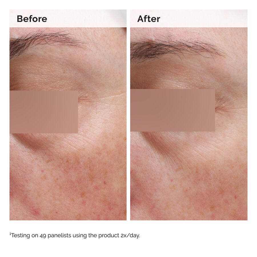 Niacinamide 5% Face and Body Emulsion - US 4041