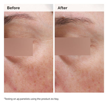 Niacinamide 5% Face and Body Emulsion - US 4041