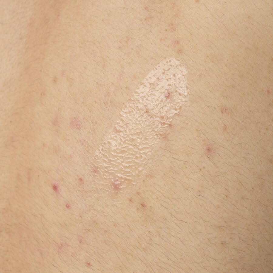 Salicylic Acid 0.5% Body Serum - US 5976