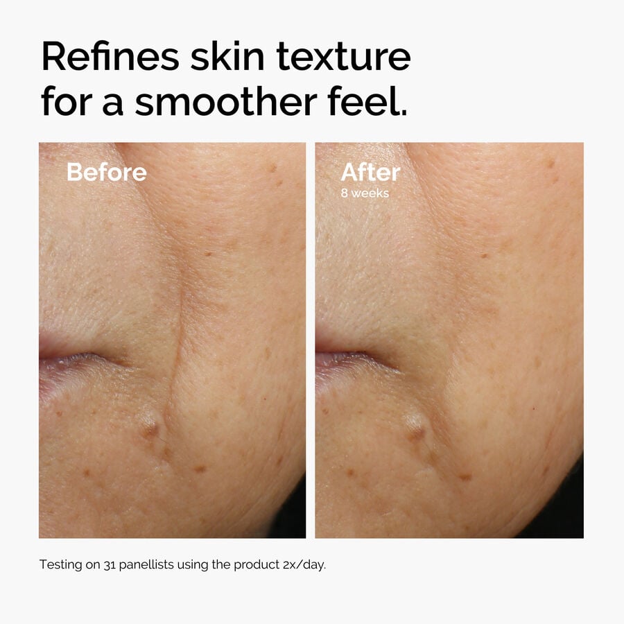 Caffeine 3% + Escin 1% Face Serum - US 6057