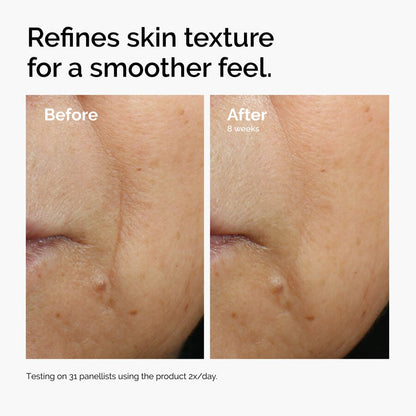 Caffeine 3% + Escin 1% Face Serum - US 6057