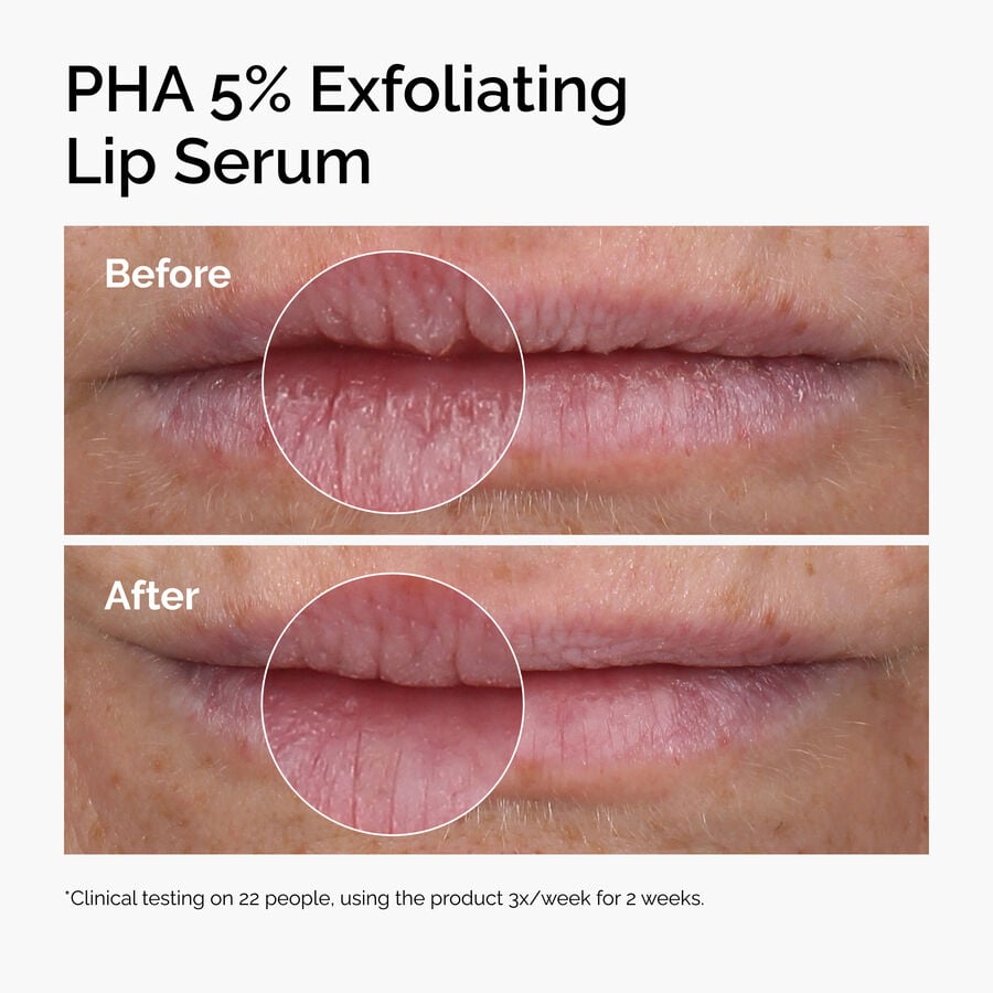 PHA 5% Exfoliating Lip Serum - US 9871