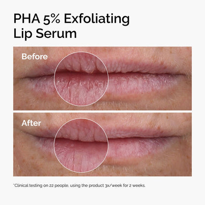 PHA 5% Exfoliating Lip Serum - US 9871