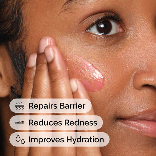 Soothing &amp; Barrier Support Serum - US 3178